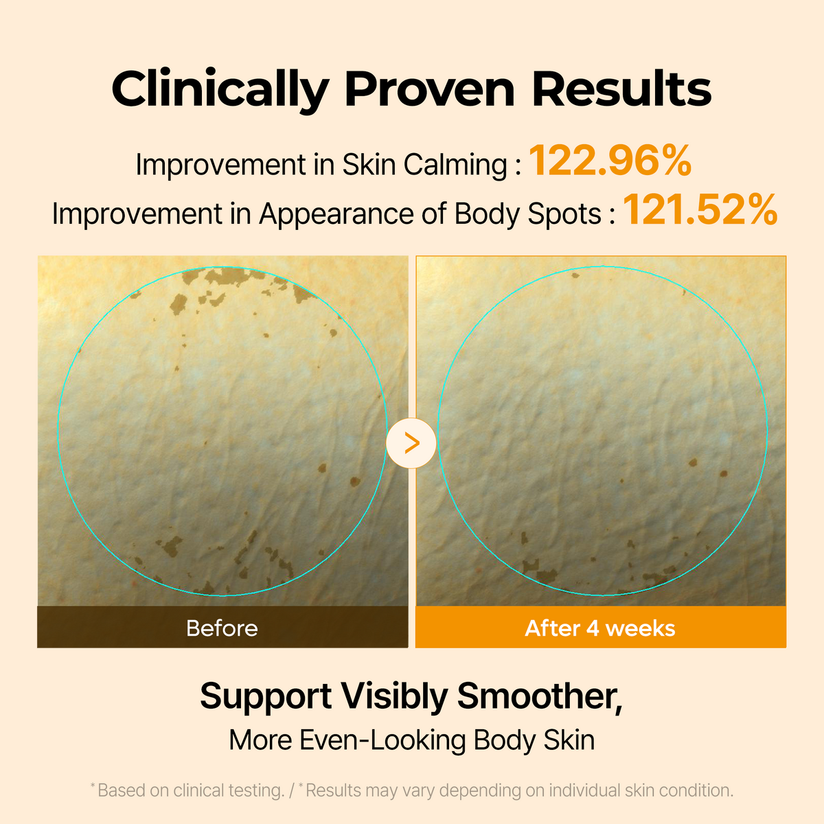 Kojic Acid Turmeric Capsule Body Cream