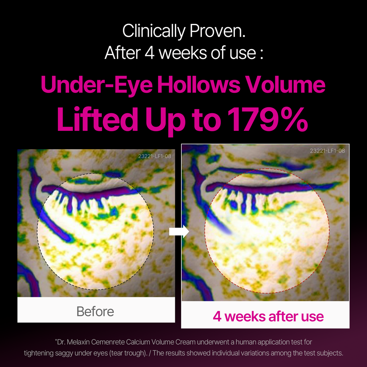 Calcium Eyecare Routine Set