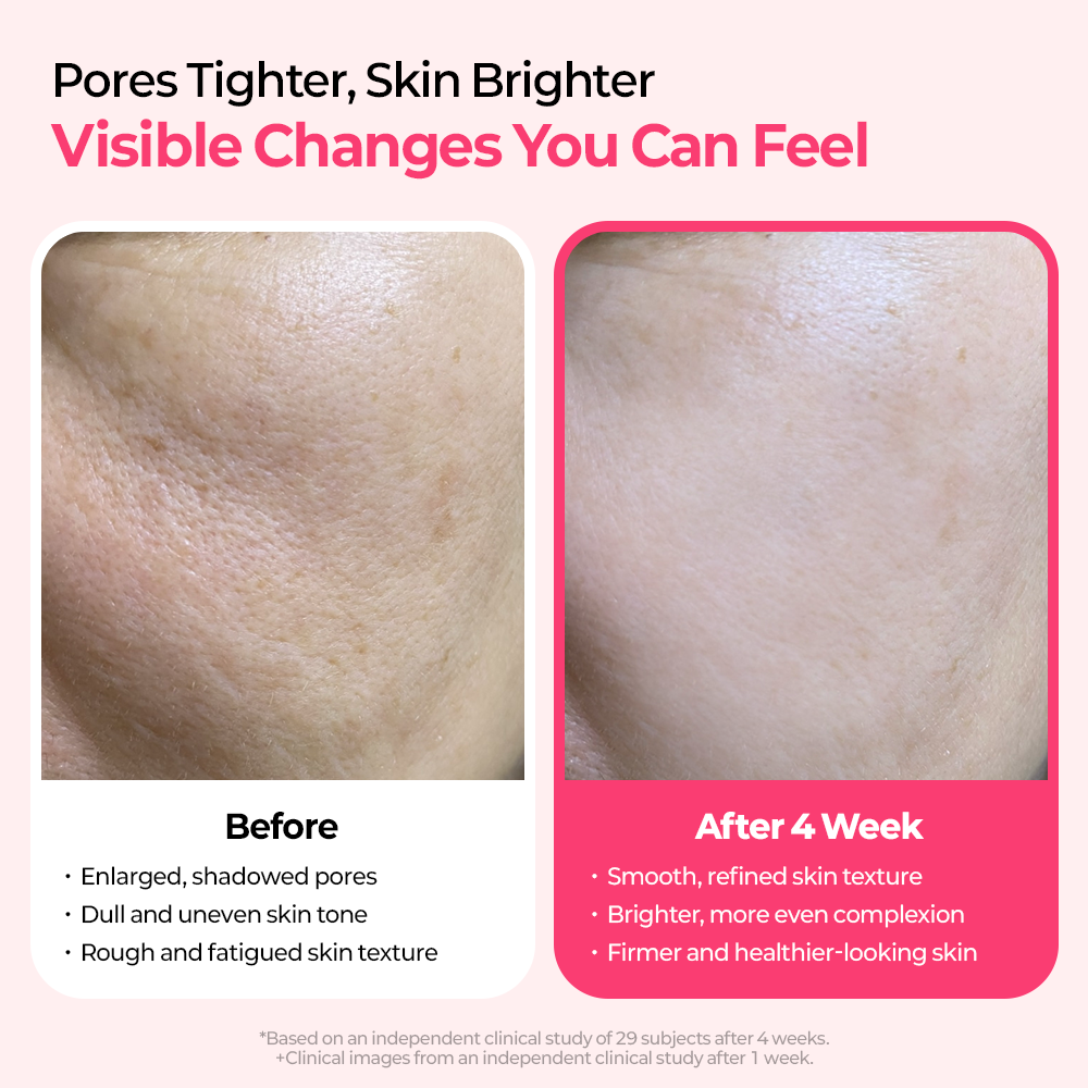Cemenrete Cyano Pink Spicule Serum